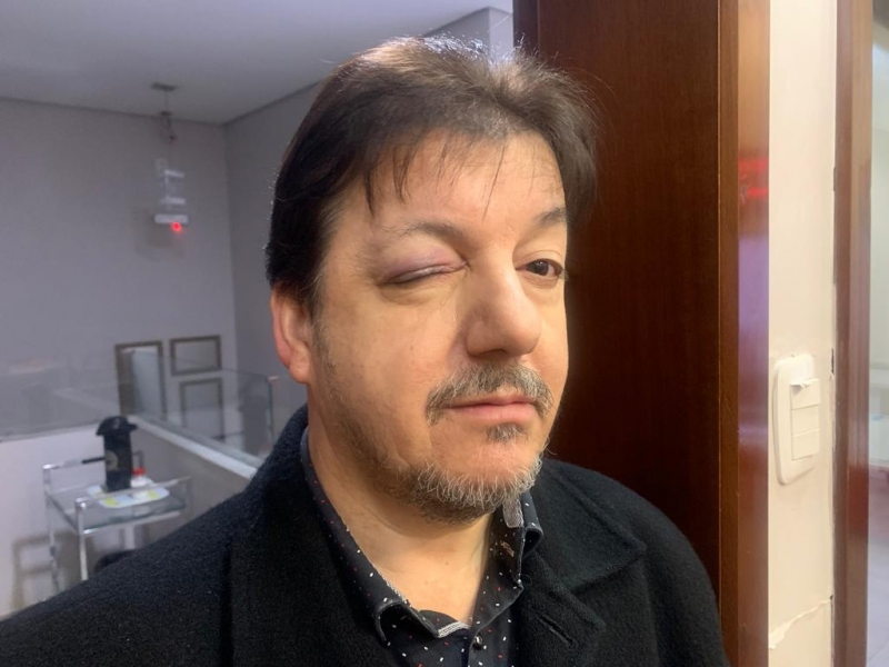 Pastor é agredido por adolescentes ao separar briga em Santo Ângelo