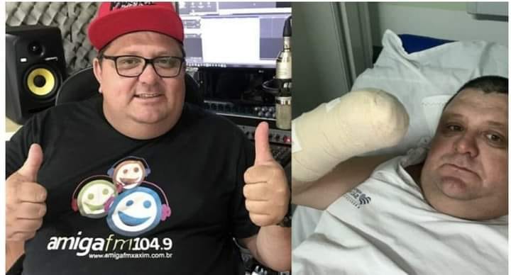 Humorista “Pilha” perde a mão após estourar foguete no Oeste de SC