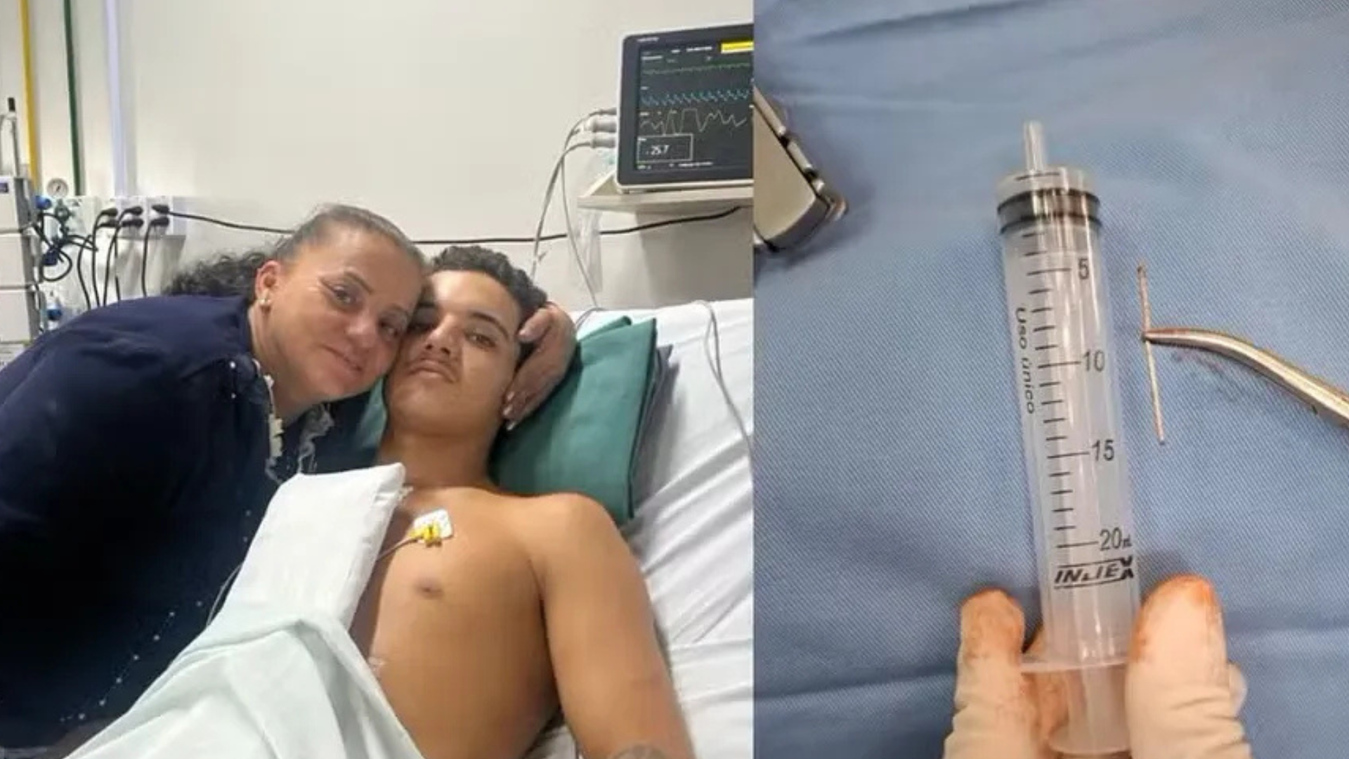 Sem querer, jovem dispara pistola de pregos no próprio coração em SC