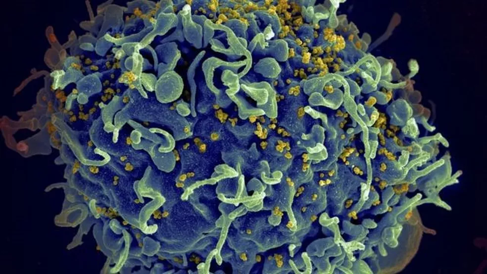 HIV: médicos anunciam 4º caso de cura.