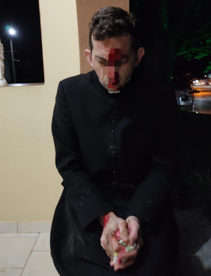 Padre é agredido durante a madrugada em paróquia de SC