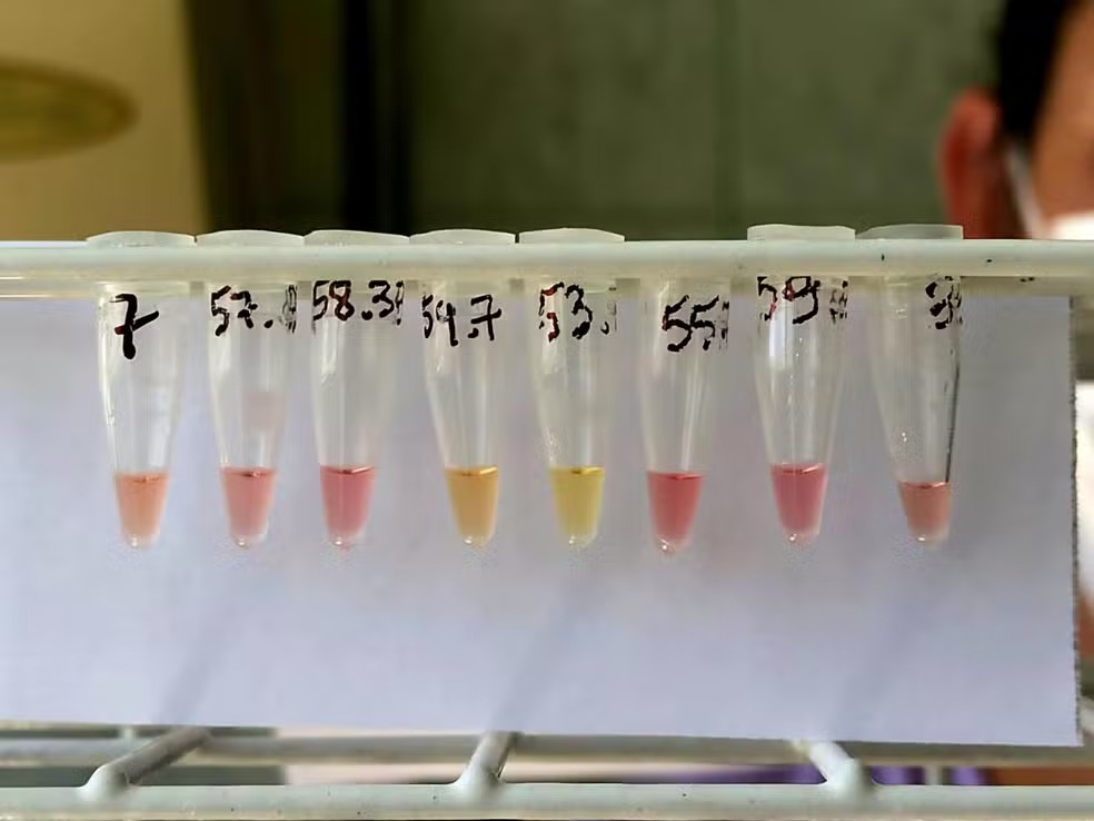 Pesquisadora da UFSM cria teste rápido para diagnóstico de tuberculose