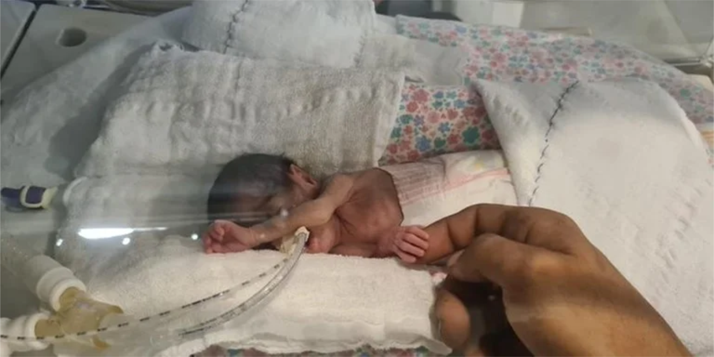 Recebe alta o bebê que nasceu com o menor peso da história do Hospital de Clínicas de Porto Alegre