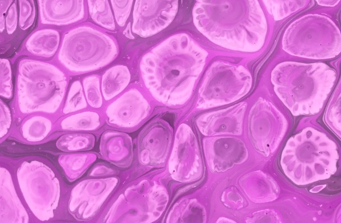 Uma pessoa morre e dezenas adoecem em surto fúngico raro nos EUA